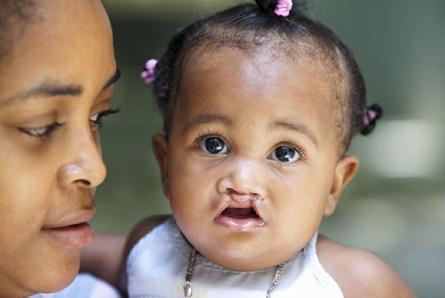 Ledbury+Operation Smile